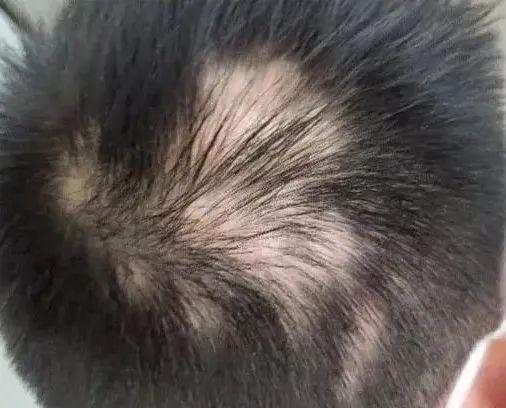 吐槽|小学生“秃然”不好了，别只是感伤吐槽