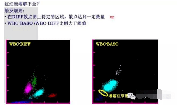 血常规白细胞散点图不会看你肯定没看过这些图