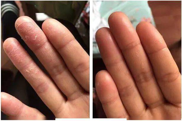 肌肤|30年老国货，别因便宜而嫌弃，一瓶用全身，真正实力派