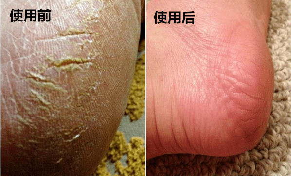 肌肤|30年老国货，别因便宜而嫌弃，一瓶用全身，真正实力派