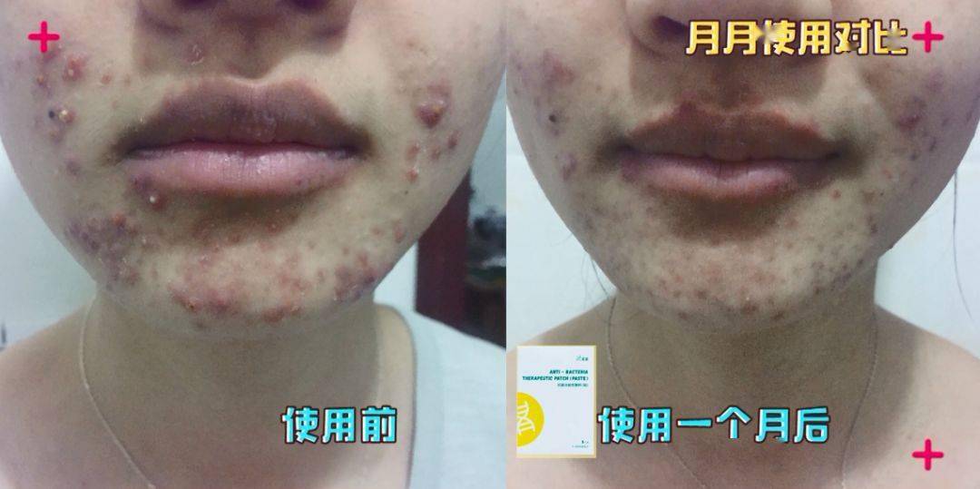 救星|这款PS级的“烂脸救星”，让我抛弃了SKII的“前男友面膜”！