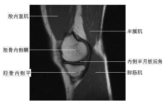 影像解剖全身常规x线骨关节mri断层解剖大全