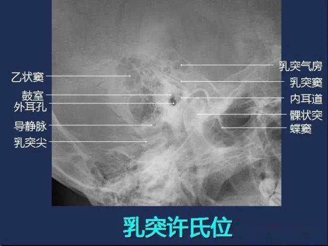 影像解剖全身常规x线骨关节mri断层解剖大全