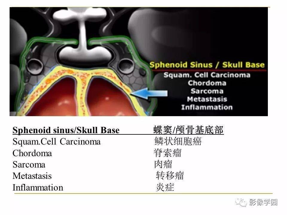 图解蝶鞍及鞍旁区域解剖