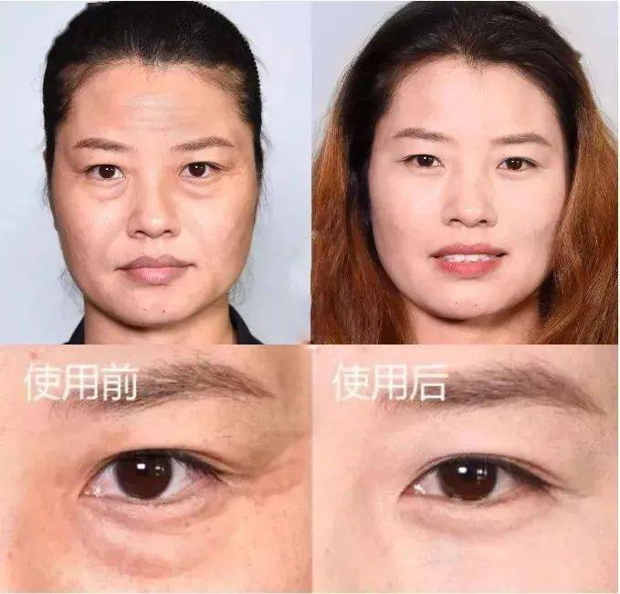 方法|眼袋显老又显丑，教你一方法轻松干掉它！！