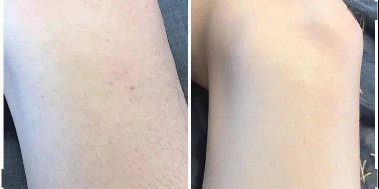 不知道|用1颗糖洗澡是什么体验？不洗都不知道身上这么脏，竟然还能扣出油脂粒！