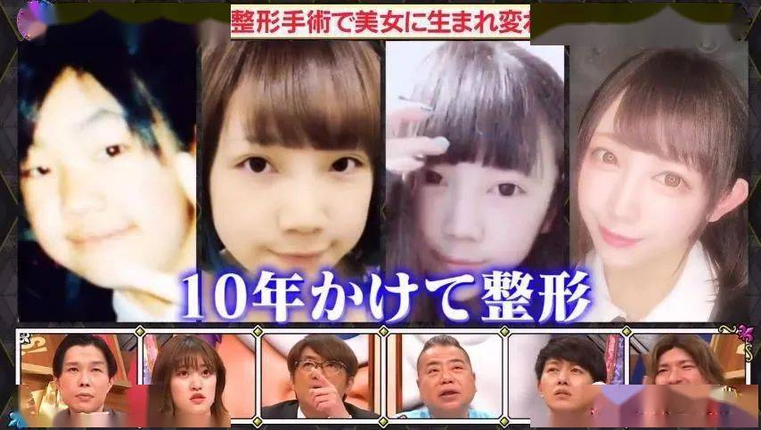 几岁开始整容 1474ded82925477a8c4b18893f20dd09.jpeg