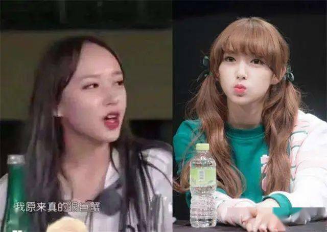 骄傲|守住发际线，是我最后的骄傲