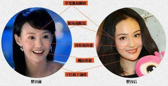 桃仔|整容黑历史都自曝了,景甜真是个狠人啊!