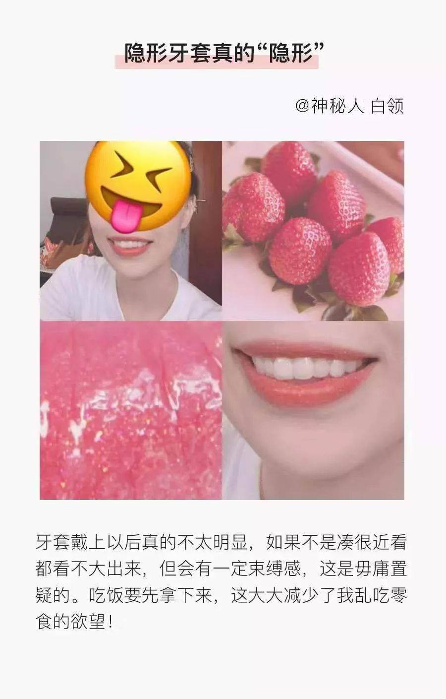 牙齿|“不会吧，不会吧，现在还有没整过牙的明星吧？”