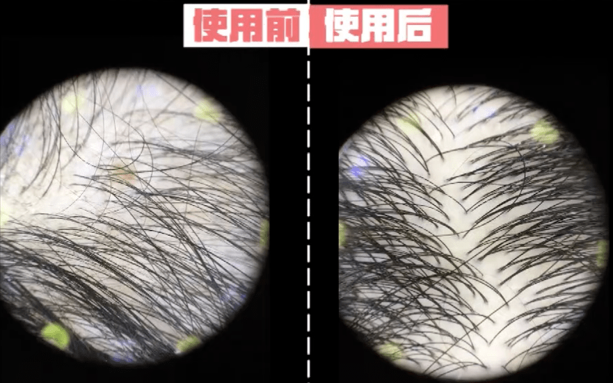 头发|大写的服！热巴居然连一根细小的发丝都不放过...