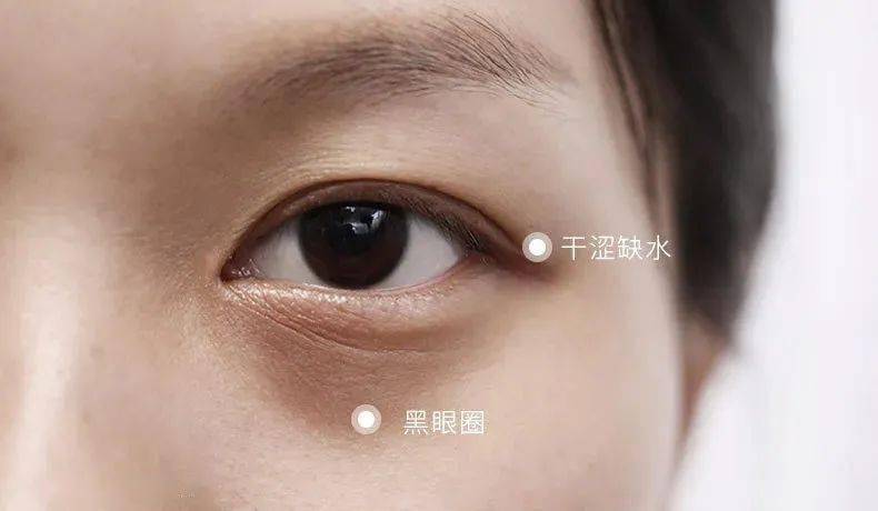 黑眼圈|blingbling大眼秘诀！早晚滚两下，赶走黑眼圈、细干纹！