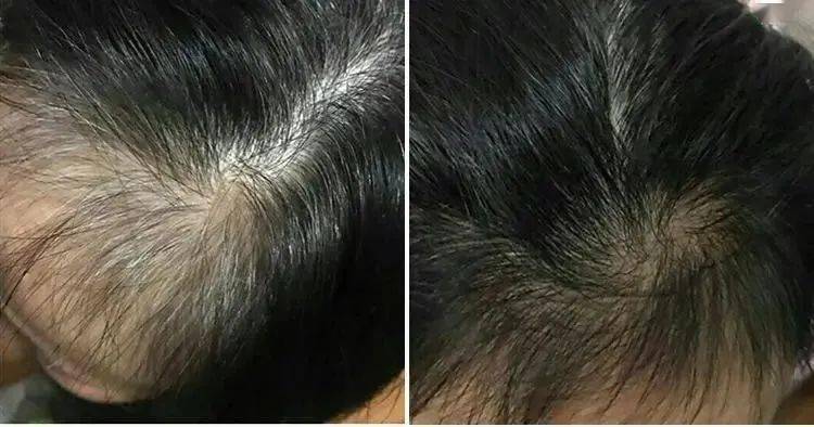 头发|大写的服！热巴居然连一根细小的发丝都不放过...