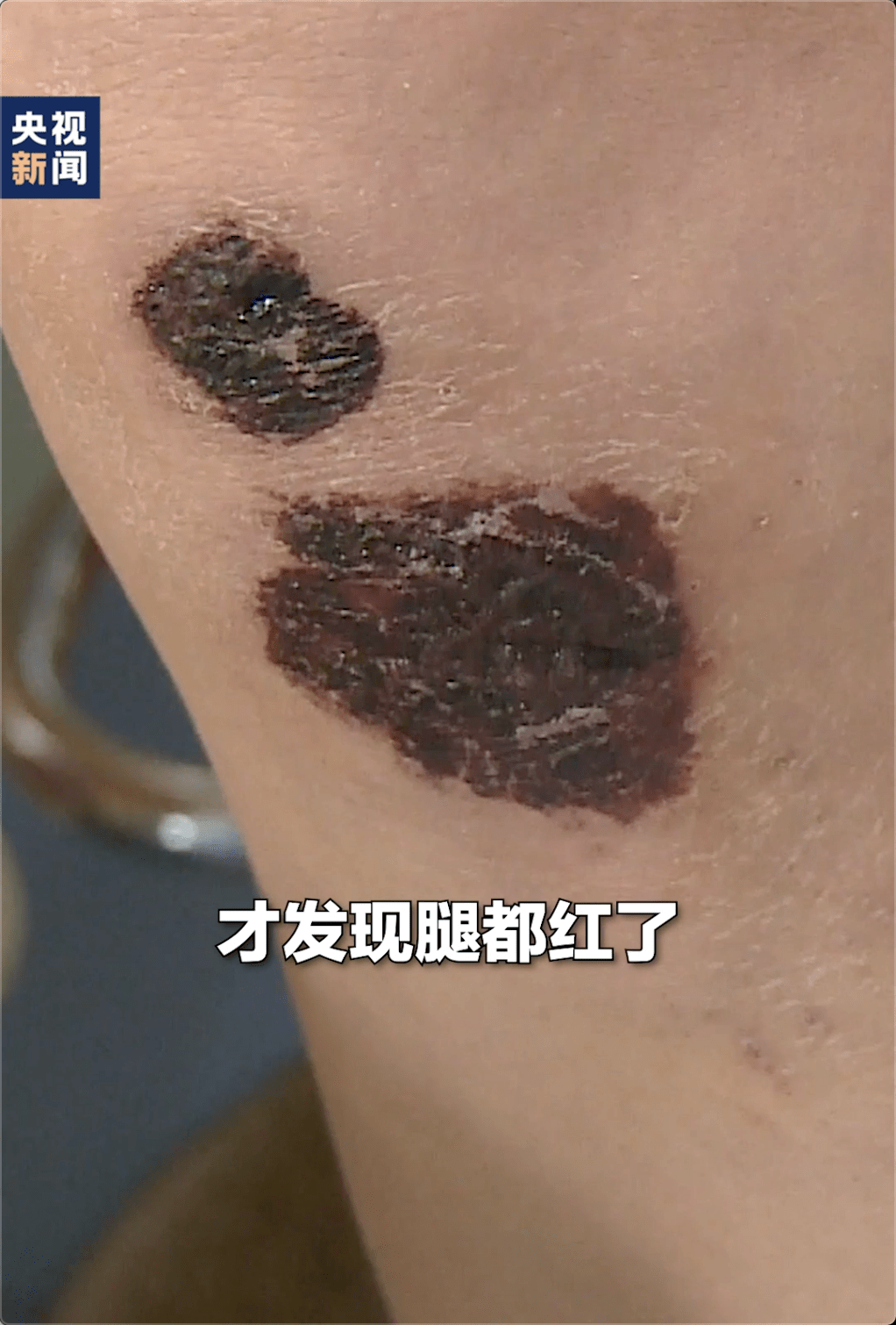 cb89f571c61a4f1b98c005752a4a4112.png