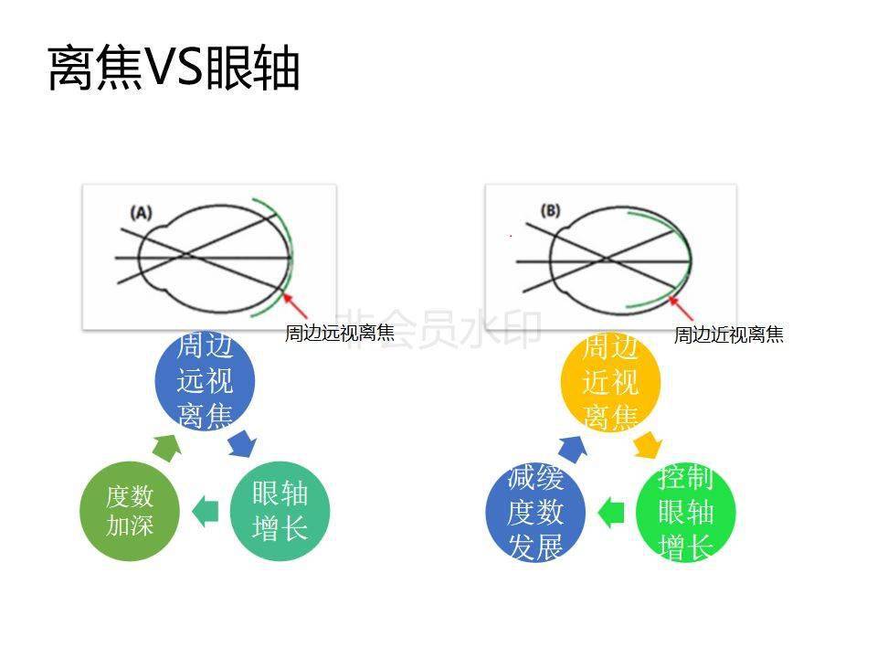 眼视光离焦软镜介绍