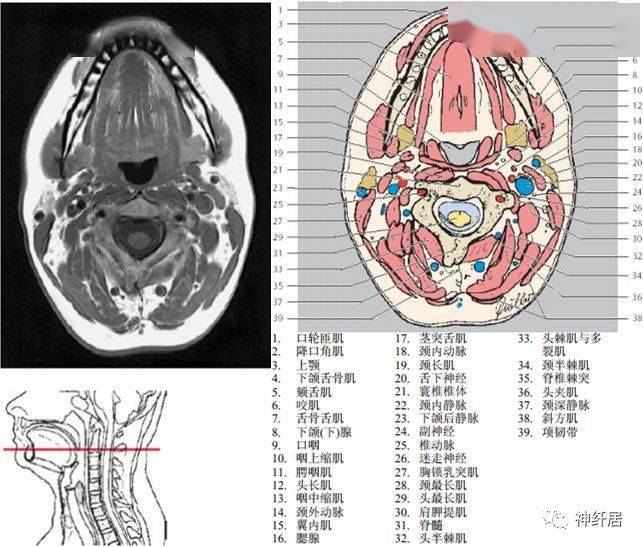 颈部详细的断层解剖