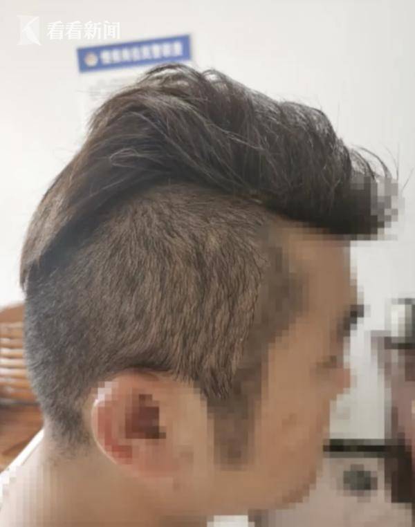 头发|为躲毒检男子自动“地中海”，民警一撸头惊到了