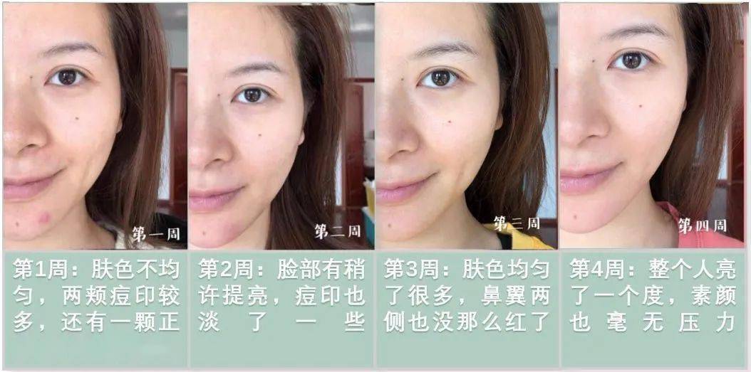 皮肤|43岁的李小冉“怼脸照”曝光，骗了所有人，冻龄女神根本不是天生的！