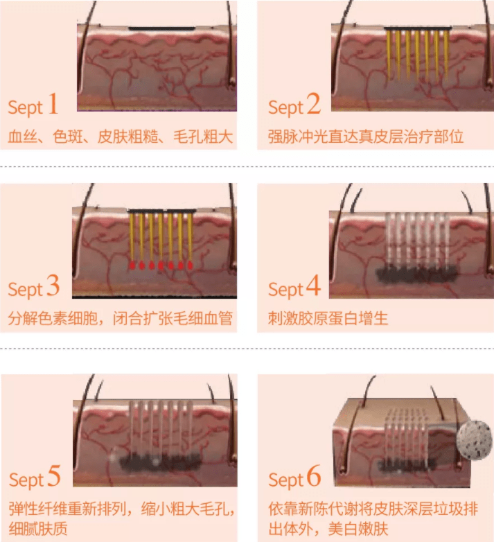 直播|“郑爽直播情绪失控大吵大闹?” 网友:求求你别再作了!