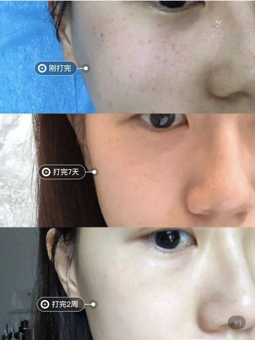 直播|“郑爽直播情绪失控大吵大闹?” 网友:求求你别再作了!