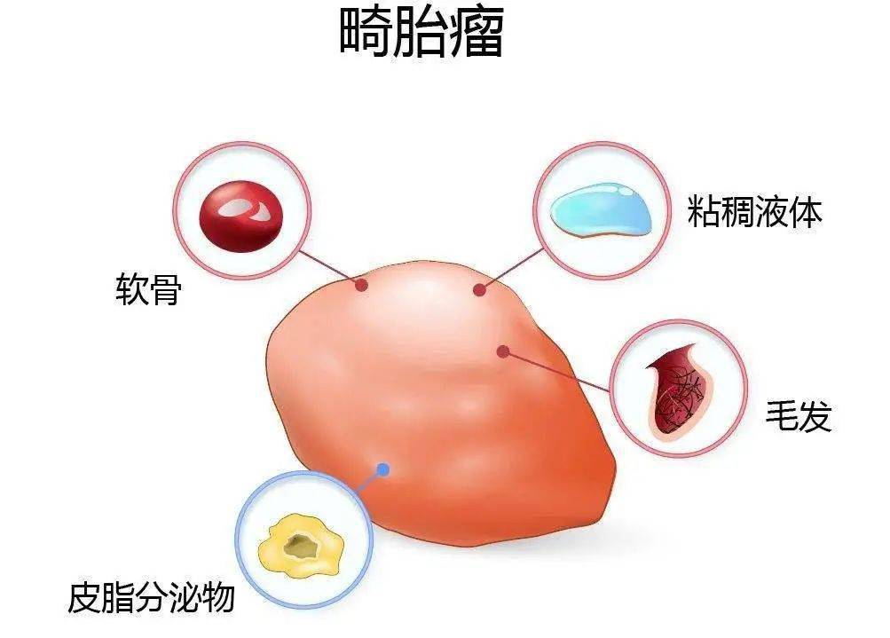 屁股|怎么回事？！婴儿屁股上竟长了“小尾巴”……