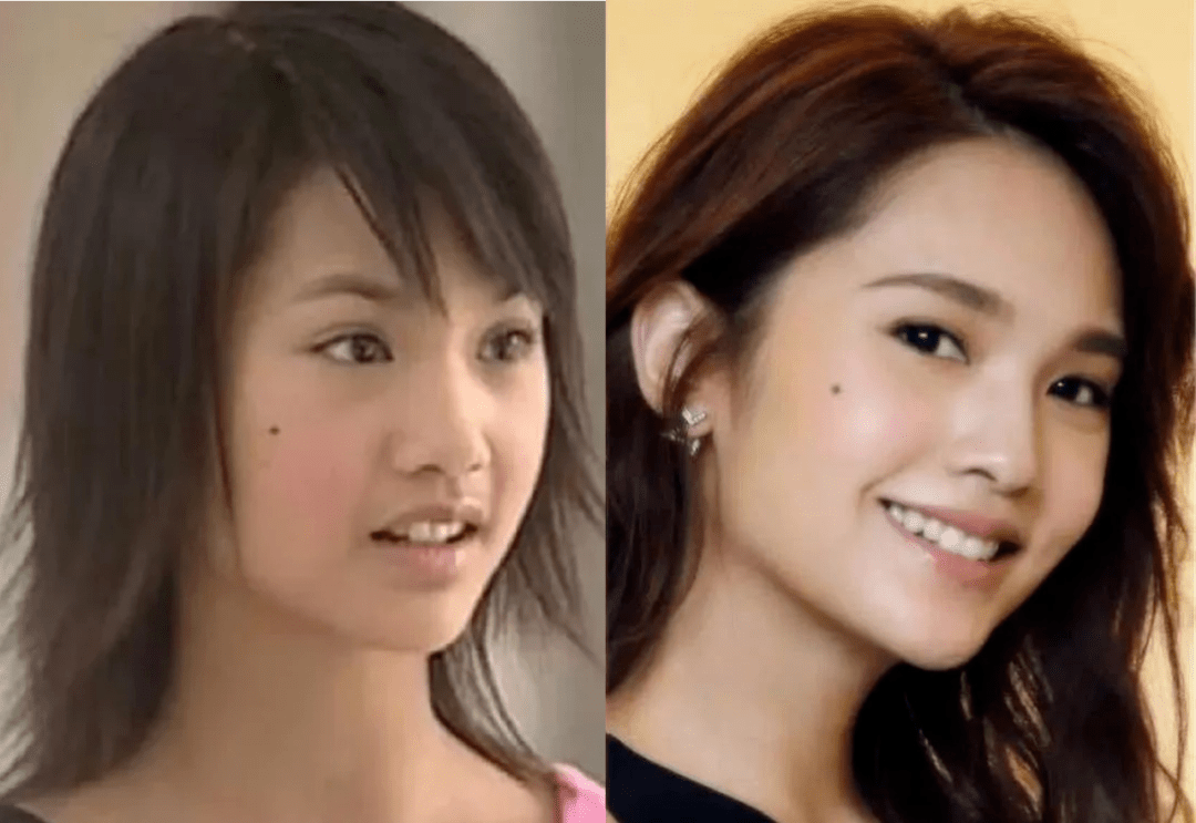 do|为什么杨丞琳do脸就能无痕保鲜20年？