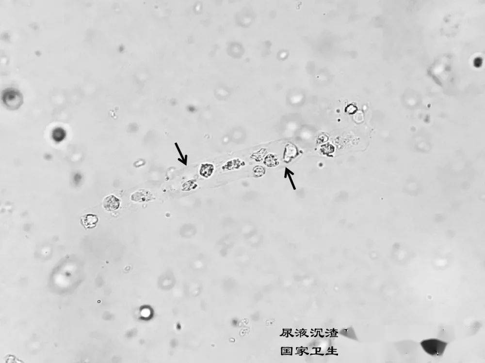 2020年尿液沉渣形态学检查室间质量评价