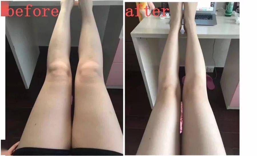 怎么才能瘦手瘦腿 dd06fa6958154560844fbfb7eaed17f5.jpeg