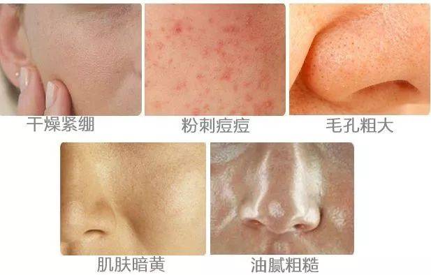 兰蔻大|这次的兰蔻大粉水跳楼价，看到直接下单抢！
