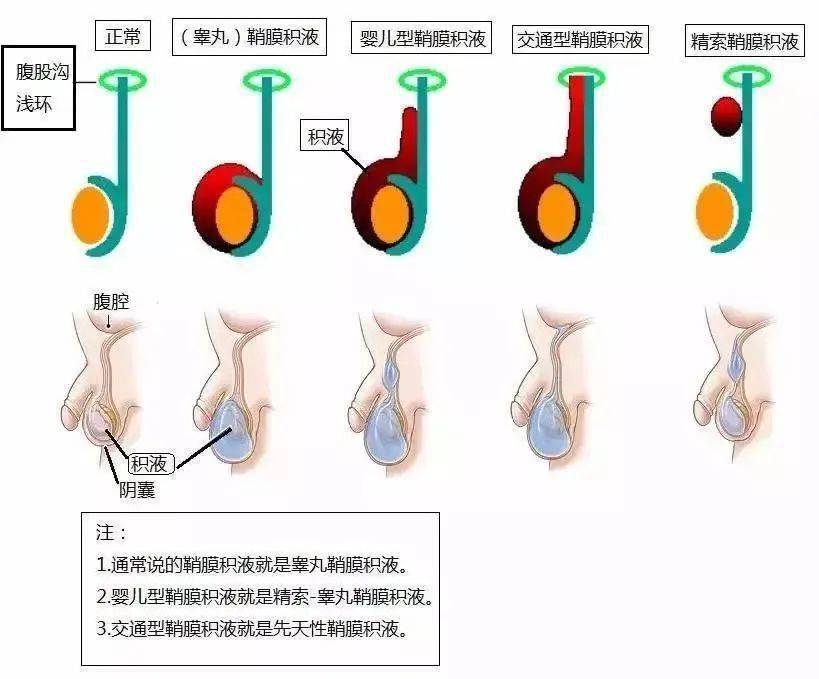 当宝宝出生后,这个管道就失去了作用,应当逐渐闭合.