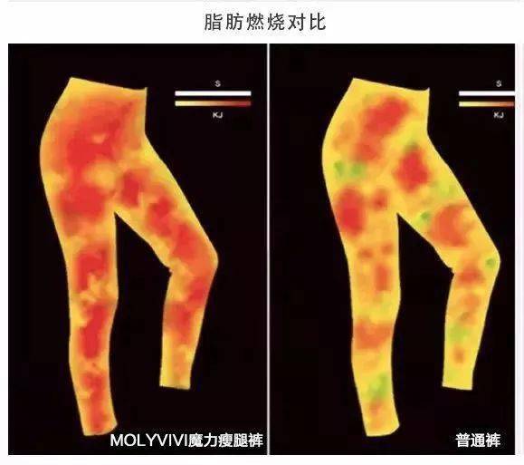 意大利|吴昕：你不瘦下来，永远不知道自己有多美！