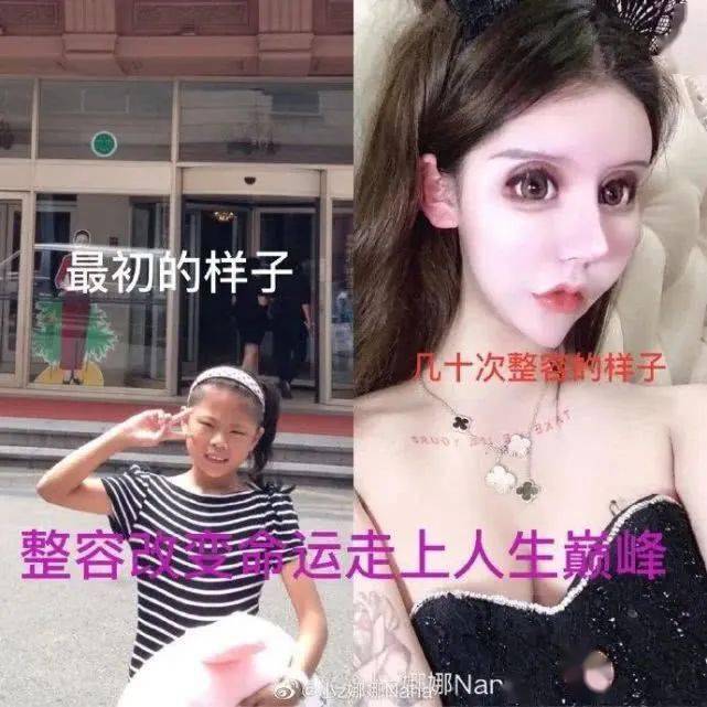 畸形|“我花100万，把女儿整成了残废”：畸形审美毒害下，有20万女孩正在消失！