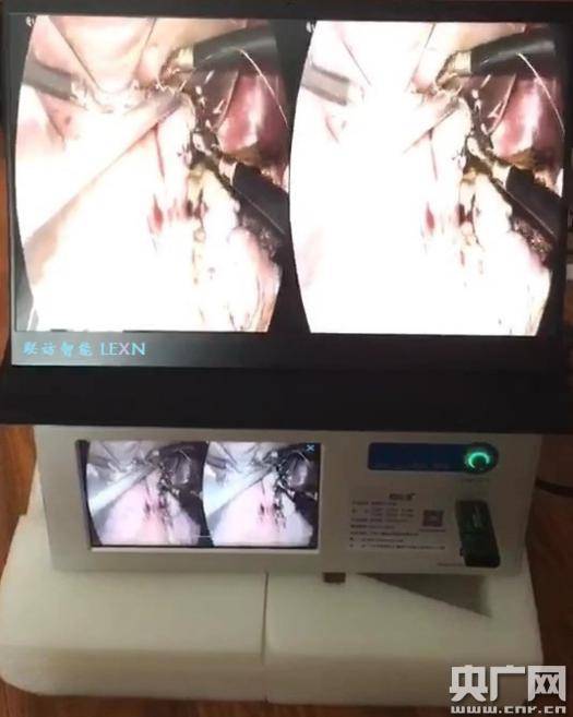 临床|“裸眼3D”技术助力医疗教学与临床培训 一台手术千人观摩将成现实