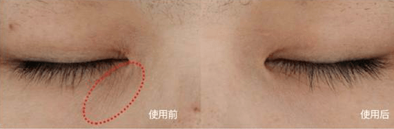 水宝宝|日本家庭主妇最爱的懒人面霜！3分钟让大干皮变成“水宝宝”！每7秒卖出一瓶，李佳琦疯狂打call！