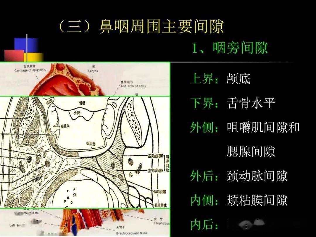 鼻咽部ct解剖