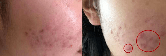 肌肤|还在敷“过气面膜”？！这款不到40元的爆款面膜让你换季肌肤都能水水润润！