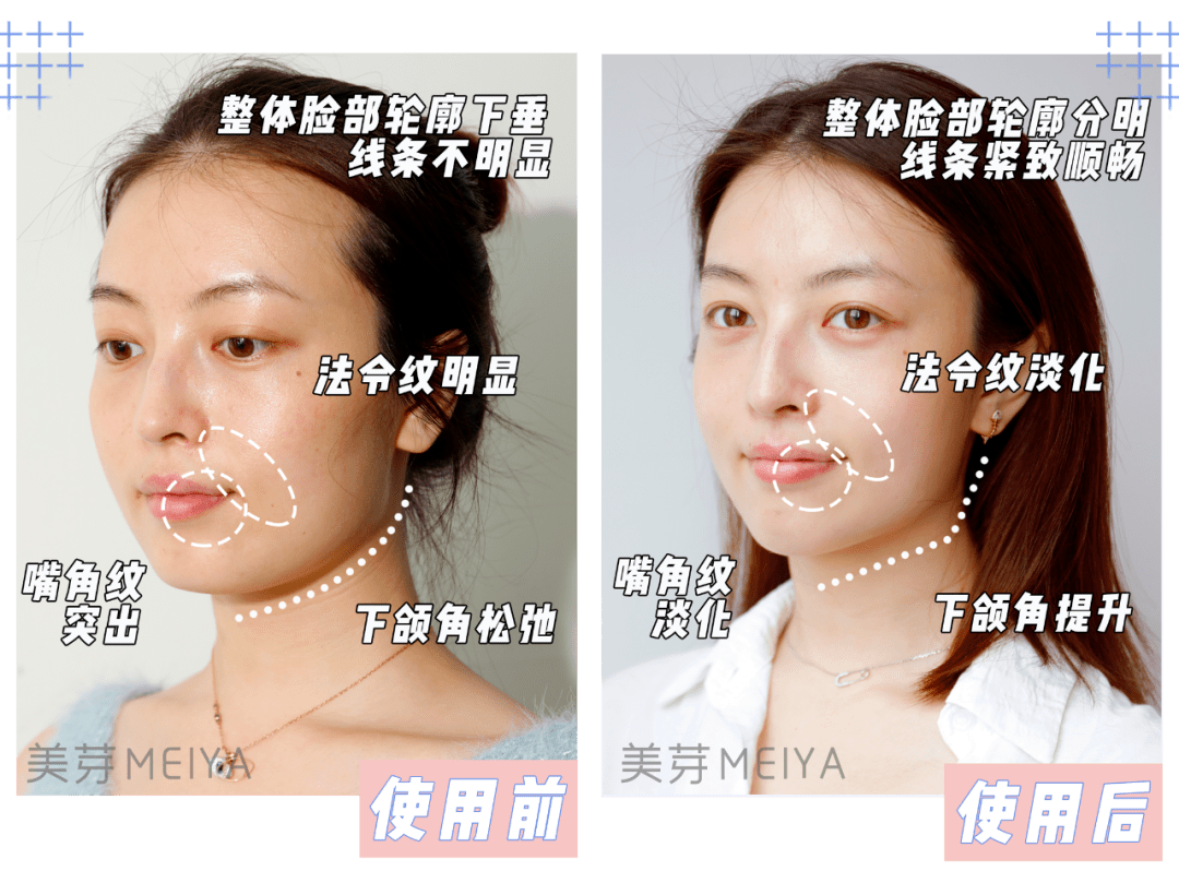 产品|为什么你的脸越来越大？原来都是因为这一点没做好？