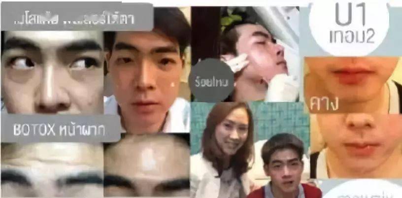 生活|泰国小哥花15万整形，成功从屌丝逆袭变男神！