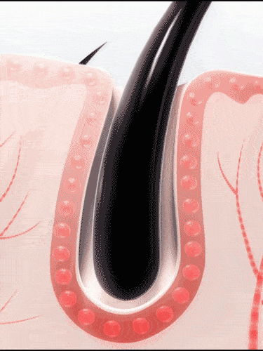 索芙特|原来发际线后移还能这样遮!我终于可以拥有“海藻头”啦