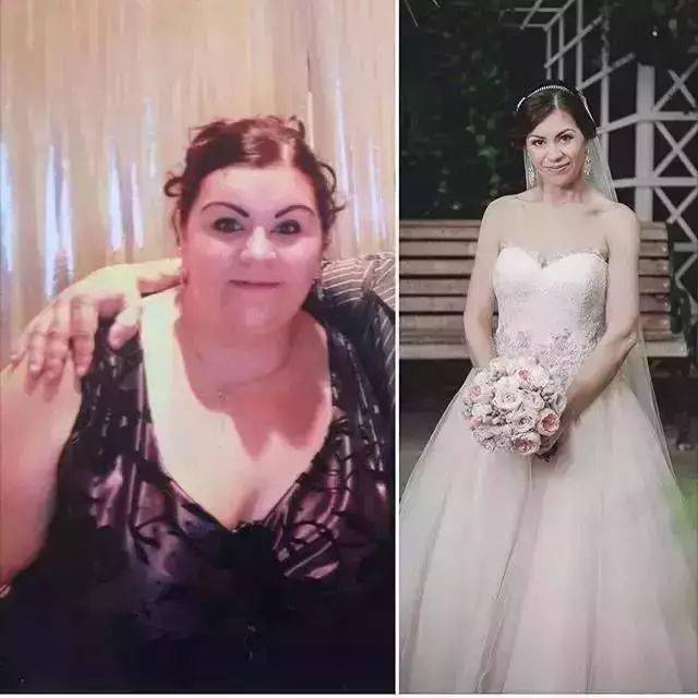 生活|泰国小哥花15万整形，成功从屌丝逆袭变男神！