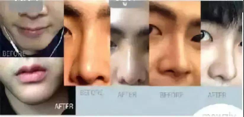 生活|泰国小哥花15万整形，成功从屌丝逆袭变男神！