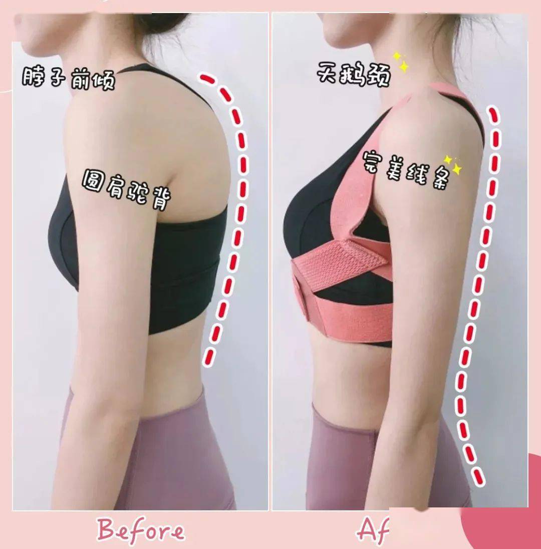 智商|张雨绮的矫姿带到底是智商税，还是真女神制造机？