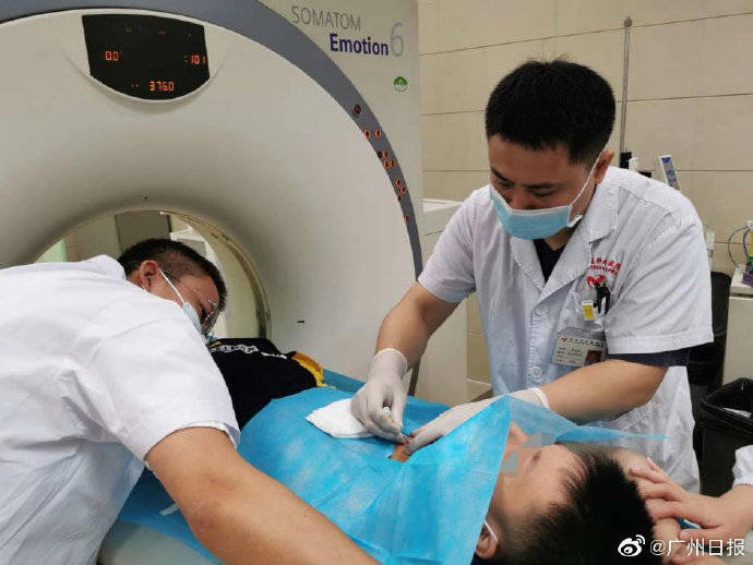 小家|渴了就喝碳酸饮料、果汁12岁小学生被查出肺癌晚期 家长:儿子白开水基本不喝