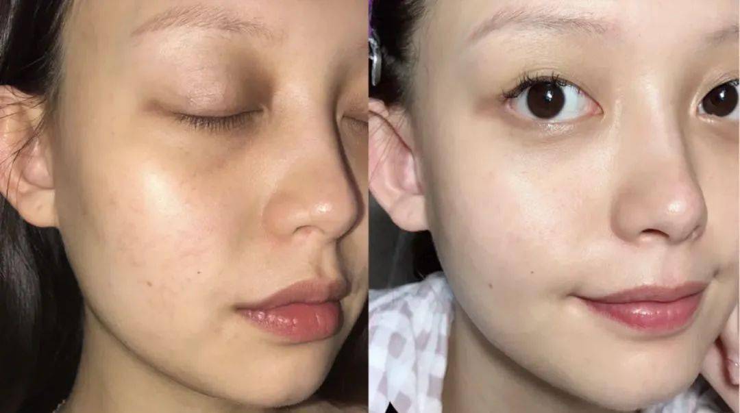 日本|日本人用酒洗脸，60岁还没有皱纹，黑头粉刺全消失，整张脸白皙光滑，细腻弹润！