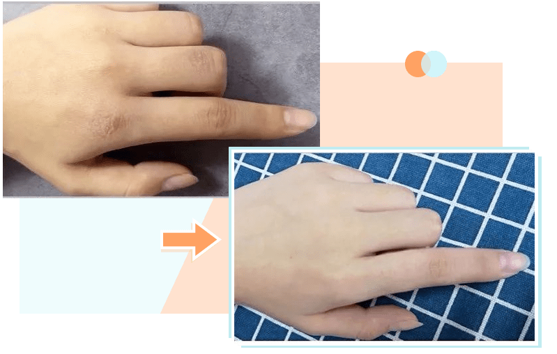 肌肤|因为粗糙的手,丢了颜值还越来越自卑,还好有它拯救了....