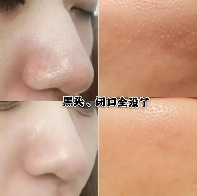 肌肤|科颜氏3.4折！不抢亏爆！两款便宜又大碗的保湿&清洁面膜，最低仅109元！