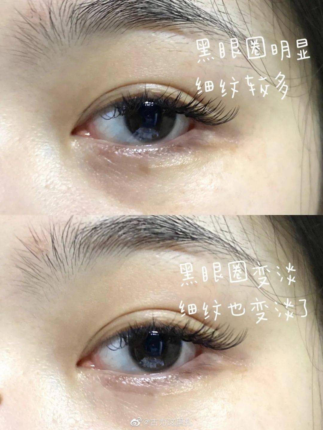 禾葡兰|庄里爱美仙女必看！明星都在用的眼膜液，仅需7.7元！