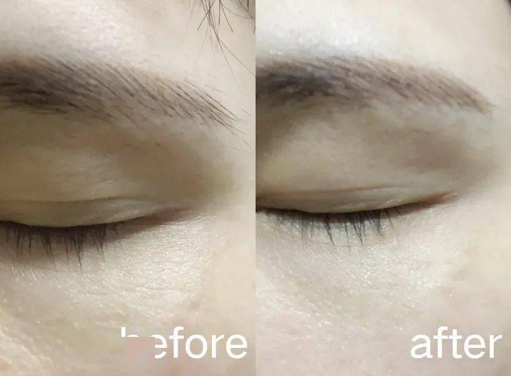 禾葡兰|庄里爱美仙女必看！明星都在用的眼膜液，仅需7.7元！