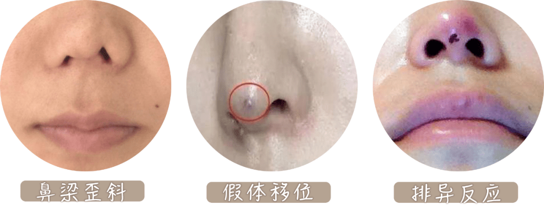 双眼皮|为什么“整容脸”女孩,更受直男欢迎?