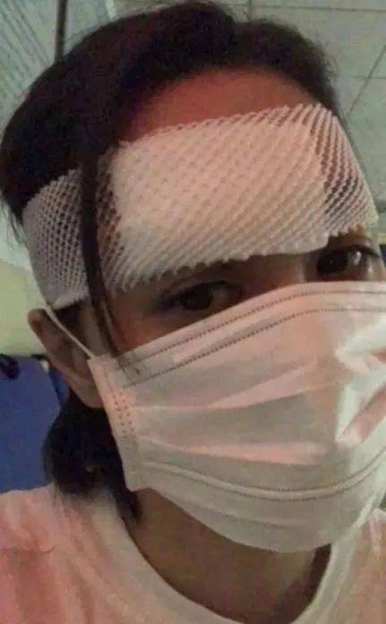 受伤|阿娇破相缝66针 太快复工被批炒作